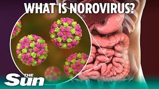 What is norovirus and how long does sickness bug last [upl. by Nahgen]