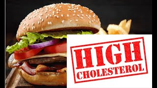 Dr Whiting On Dr Mercolas High Cholesterol Review [upl. by Gurango]