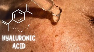 Does Hyaluronic Acid Really Works [upl. by Darrel]