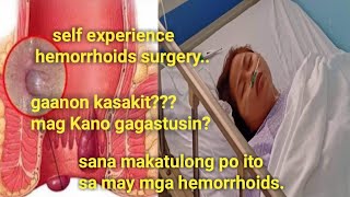 hemorrhoidectomy surgery Gaano kasakit magkano Ang gastos [upl. by Weinert]