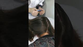 ASMR School Nurse LICE Check  Lice Removal with Tweezers Real Person asmr shorts short [upl. by Rus365]