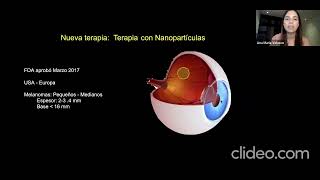 Lo nuevo en melanoma de coroides Dra Ana Maria Velasco Silva [upl. by Obidiah765]