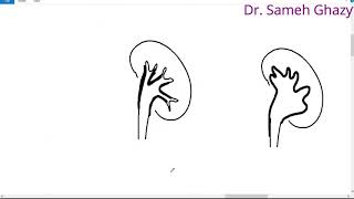 systemic pathology 52  Urinary system 6  obstructive uropathy  DR SAMEH GHAZY [upl. by Debera]