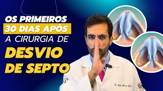 30 dias após cirurgia do septo nasal O que você PRECISA saber [upl. by Redford111]