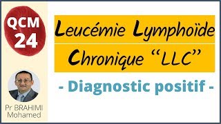 Leucèmie Lymphoide Chronique Diagnostic Positif  Hématologie QCM 24 [upl. by Ysteb]