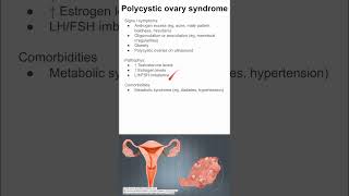 Polycystic ovary syndrome [upl. by Fine]