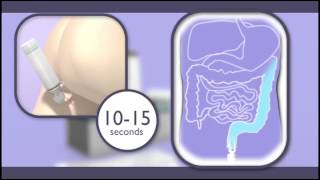 Ultrasound Transducer Manipulation [upl. by Yelac]