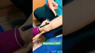 Mantoux test 🩸laboratory medical bmlt dmltvideo samplecollection 🥼💉💉 [upl. by Ted]