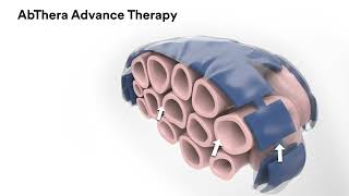 3M™ AbThera™ Advance Mechanism of Action Video [upl. by Sinaj10]