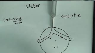 Weber Test made easy SensoneuralConductive hearing loss USMLE [upl. by Evelc]