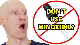 Why I Hate Topical Minoxidil Rogaine [upl. by Ehtyde853]