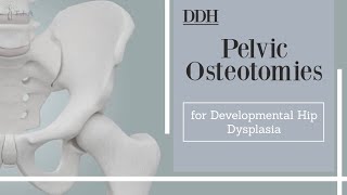 Pelvic Osteotomies for Developmental Hip Dysplasia  DDH [upl. by Larsen]