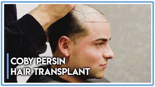 Coby Persin Hair Transplant Experience in Turkey 2021 [upl. by Noirb]