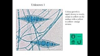 Identification of dermatophytes [upl. by Maleen]