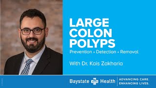 quotLarge Colon Polyps Prevention Detection Removalquot 5624 [upl. by Derry]