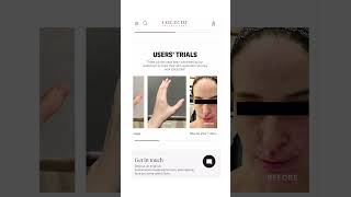 Stem Cell Skincare Results You WONT Believe [upl. by Eadrahc]