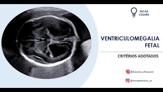 Ventriculomegalia fetal como avaliar [upl. by Yaf]