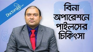 Piles treatment without surgery  Hemorrhoid Removal  অপারেশন ছাড়া পাইলস এর চিকিৎসা  Piles [upl. by Repip396]