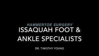 Hammertoe Surgery [upl. by Tanny38]