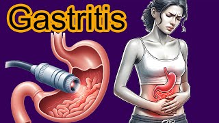 5 Early signs of Gastritis Gastritis diagnosis and treatment [upl. by Navinod]