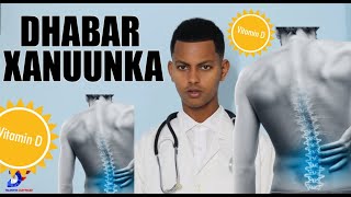 DHABAR XANUUNKA IYO VITAMIN D [upl. by Gunn]