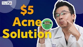 5 Acne Treatment  Cheapest Way To Get Rid Of Acne [upl. by Hcirdla819]