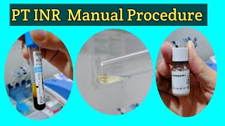 PT INR Manual Procedure Prothrombin Time Test PT Manual Test PT Manual Procedure in Urdu amp Hindi [upl. by Weiman546]