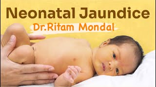 Newborn Jaundice  what to do by DrRitam Mondal MD [upl. by Mas974]