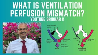 What is ventilationperfusion VQ mismatch How do we manage it neonatalventilation VQmismatch [upl. by Nic]