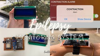 Epilepsy Monitoring System  IoTBased RealTime Seizure Detection amp Smart Alerts [upl. by Anitroc]