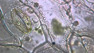 Stomatal Closure in Tradescantia Leaf Cells [upl. by Yurik]