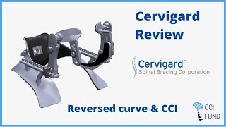 Cervigard Review for Reverse Curve amp CCI [upl. by Clim]