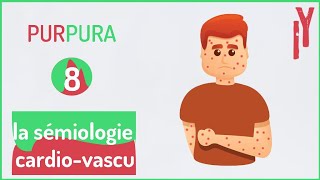 EPISODE7 sémiologie cardiovasculaire purpura [upl. by Gibb386]