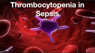 Thrombocytopenia in Sepsis [upl. by Pernas347]