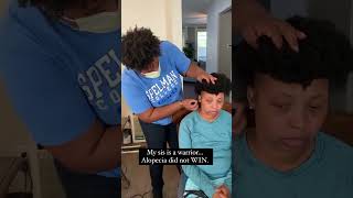 Best Hairstyles For Thinning Hair Hair Loss Haircuts [upl. by Anerbas]