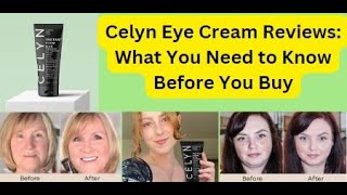 Celyn Eye Cream Reviews what you need to Know [upl. by Stover]