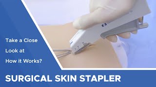 Surgical Skin Stapler Take a Close Look at How it Works [upl. by Llenil]