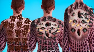 ASMR Deep Cleaning Treatment Animation of Females Back  2d ASMR Animation [upl. by Retsehc]