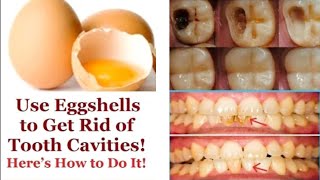 Use Eggshells To Get Rid Of Tooth Cavities HERE’S HOW TO DO IT [upl. by Etnauq]