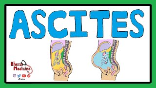 ASCITES  Serum Ascites Albumin Gradient SAAG  Ascites Pathophysiology  Ascites Causes [upl. by Dyson521]