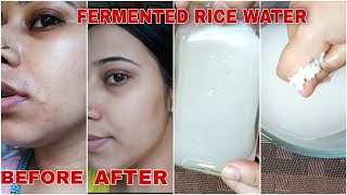 DIY Fermented Rice Water Toner For Clear Spotless Glowing amp Brighter Skin [upl. by Gilud]