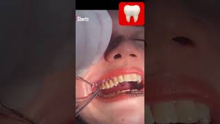 PROSES CABUT GIGI GERAHAM BUNGSU ATAS ‼️🥹doktergigiwawansumantri cabutgigi dentist [upl. by Nosraep]