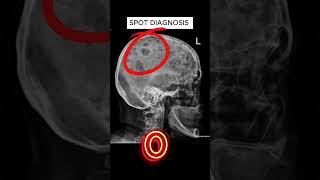 X ray quiz 37 nursing nursingstudent doctor USMLE MBBS hospital anatomy ctscan radiology [upl. by Sachiko]