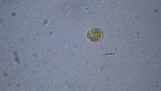 Dinoflagellate Swims the Salt Pond [upl. by Lonergan]