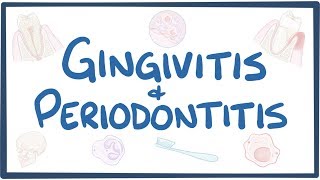 Gingivitis and periodontitis  causes symptoms diagnosis treatment pathology [upl. by Lemar178]