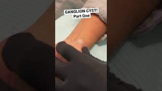 SHORT GANGLION CYST [upl. by Hyacinthie]