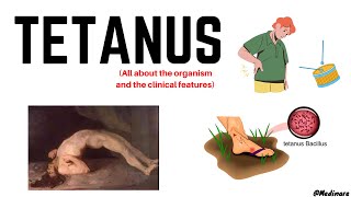 Tetanus  Part 1  In just 10 minutes  Medinare [upl. by Lynad]