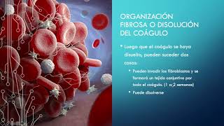 HEMOSTASIA y COAGULACIÓN SANGUÍNEA  GUYTON FISIOLOGÍA [upl. by Hiram]