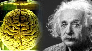 How Einsteins Brain was Different [upl. by Ocire]