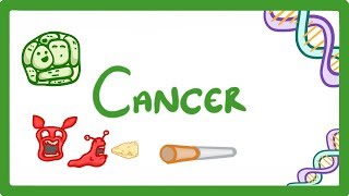 GCSE Biology  What is Cancer Benign and Malignant Tumours Explained 43 [upl. by Lamahj]